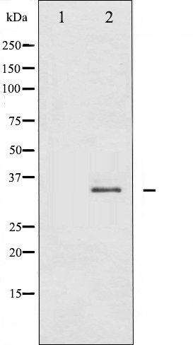 FOSB Antibody (OAAJ02832) in COS7 whole cell lysates using Western Blot
