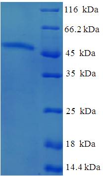 AKTIP Recombinant Protein (OPCA02458) in SDS-PAGE Electrophoresis