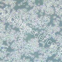 KATO III 人胃癌细胞/KATO III/KATO III细胞/KATO-III/KATO-III细胞/STR鉴定/镜像绮点（Cellverse）