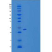 小鼠B7-H3/CD276重组蛋白C-6His