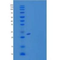 小鼠B7-H3/CD276重组蛋白C-6His