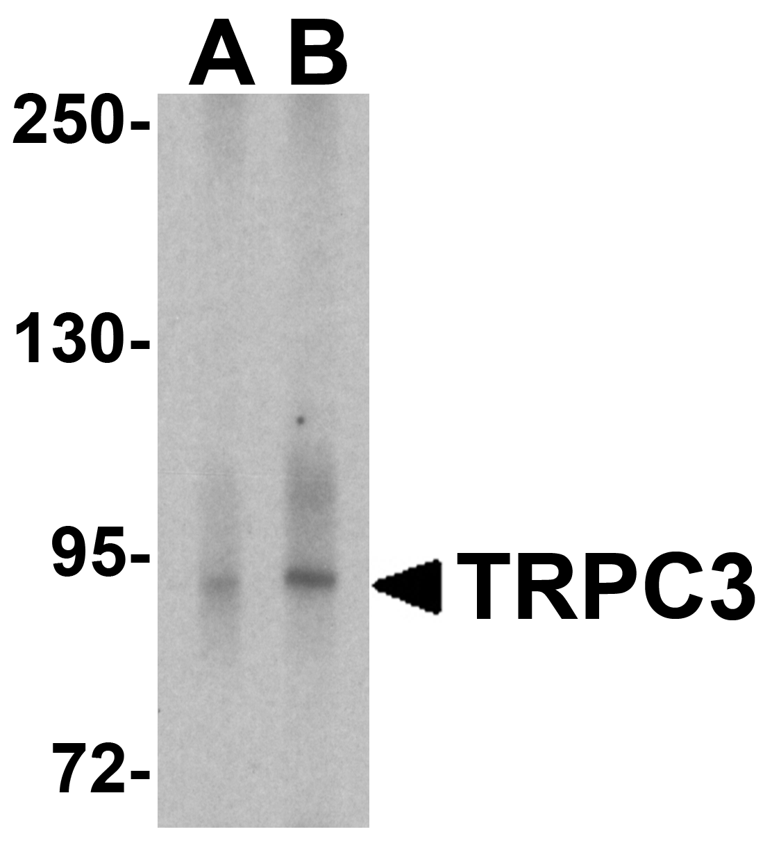 TRPC3 Antibody - C-terminal (OAPB02046) in Cerebellum tissue lysate using Western Blot