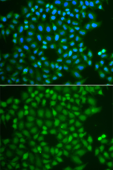 UCHL5 Antibody (OAAN02547) in A549 Cells using Immunofluorescence