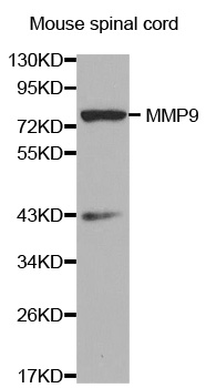 MMP9 Antibody (OAAN00717) in Mouse Spinal Cord using Western Blot