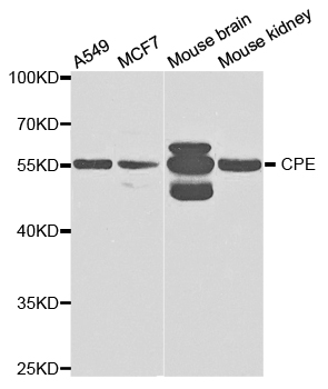 CPE Antibody (OAAN01296) in Multiple Cell Lines using Western Blot