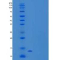 人CEACAM3/CD66d重组蛋白C-6His