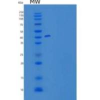 小鼠TACI/TNFRSF13B/CD267重组蛋白C-Fc