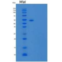 小鼠胸腺基质淋巴细胞生成素受体/TSP R重组蛋白C-Fc