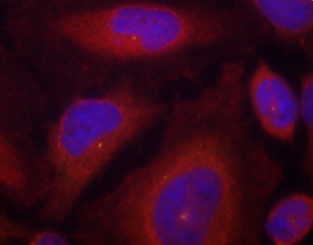 SYT1 Antibody (Phospho-Ser309) (OAAN03092) in HeLa Cells using Immunofluorescence