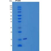 人半胱氨酸蛋白酶抑制剂2(CST2)重组蛋白C-6His