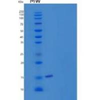 人半胱氨酸蛋白酶抑制剂2(CST2)重组蛋白C-6His