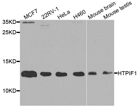 ATPIF1 Antibody (OAAN01164) in Multiple Cell Types using Western Blot