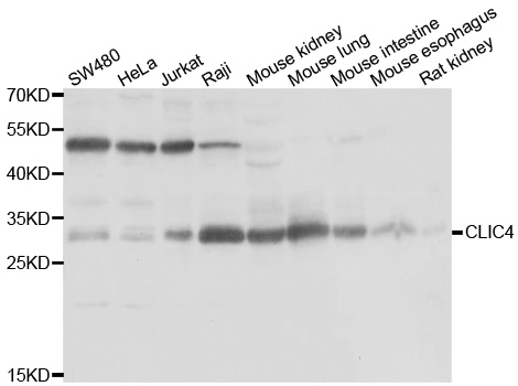 CLIC4 Antibody (OAAN02134) in Multiple Cell Lines using Western Blot