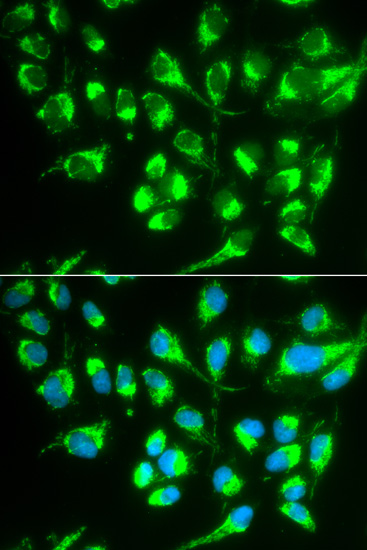 SLC22A5 Antibody (OAAN00467) in MCF7 Cells using Immunofluorescence