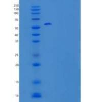 人细胞因子受体通用亚单位γ重组蛋白