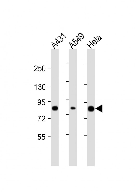 PLA2G4D Antibody - C-terminal region (OAAB21611) in Human A431 Cells, A549 Cells, HeLa Cells using Western Blot