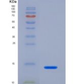 人10kDa干扰素γ诱导蛋白(IP10)重组蛋白