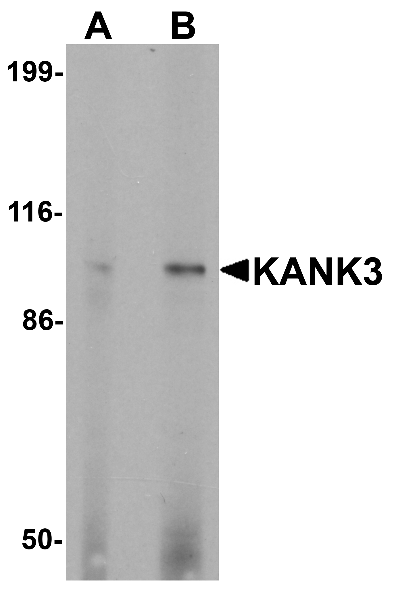 KANK3 Antibody - N-terminal (OAPB01748) in A431 cell lysate using Western Blot
