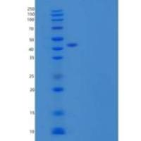人甘露糖结合蛋白C/MBL-2/MBP- C重组蛋白C-6His