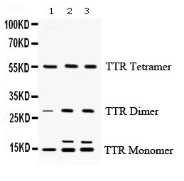 TTR Antibody (OABB02140) in Rat Liver, Mouse Liver, Mouse Testis using Western Blot