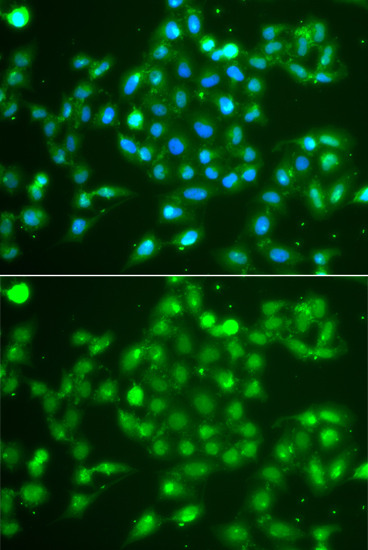 UCHL5 Antibody (OAAN02547) in A549 Cells using Immunofluorescence