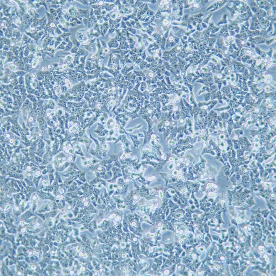 BIU-87 人膀胱癌细胞/STR鉴定细胞株/ATCC细胞系