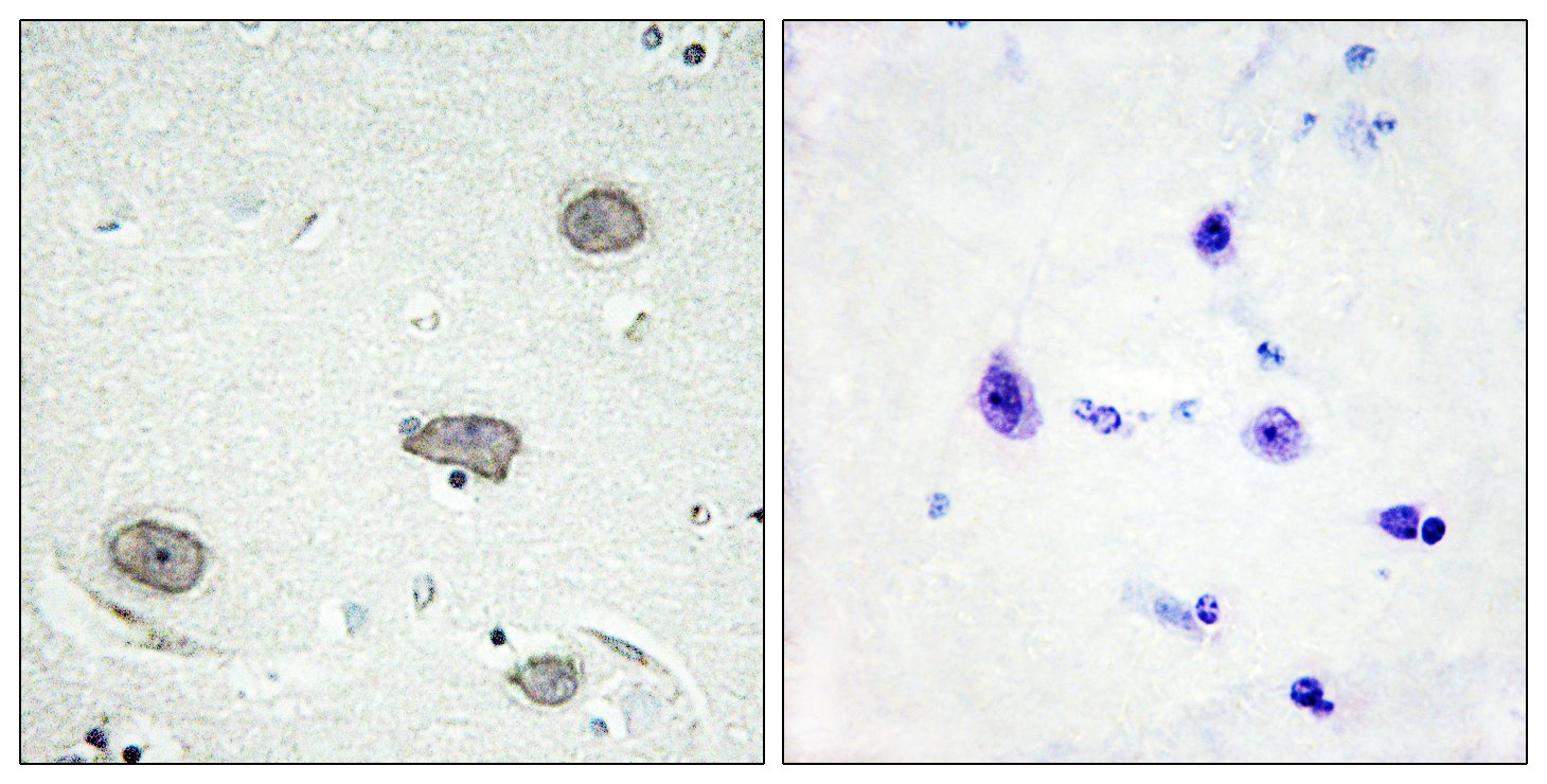CSF1R Antibody (Phospho-Tyr809) (OAAB20221) in Human Brain Cells using Immunohistochemistry