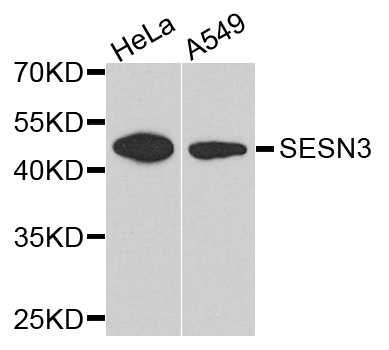 SESN3 Antibody (OAAN01166) in Multiple Cell Types using Western Blot