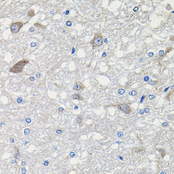 CDH23 Antibody (OAAN00960) in Rat Brain using Immunohistochemistry