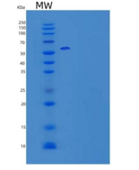 人细胞因子受体通用亚单位γ重组蛋白