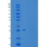 人成纤维细胞生长因子21(FGF21)重组蛋白N-6His