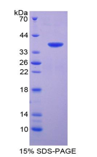KNT1 Recombinant Protein (OPCD04719) using SDS-PAGE