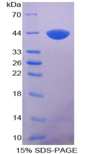 KRT5 Recombinant Protein (OPCD04768) using SDS-PAGE