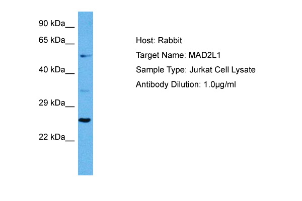 MAD2L1 Antibody - middle region (ARP80761_P050) in Human Jurkat Whole Cell using Western Blot
