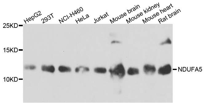 NDUFA5 Antibody (OAAN01123) in Multiple Cell Types using Western Blot