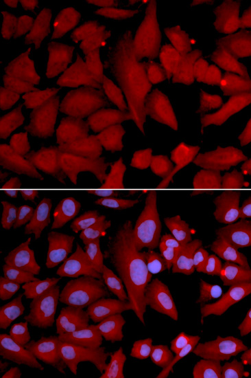 PSMA4 Antibody (OAAN00860) in U20S Cells using Immunofluorescence