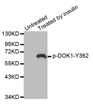 DOK1 Antibody (Phospho-Tyr362) (OAAN02889) in Jurkat Cells using Western Blot