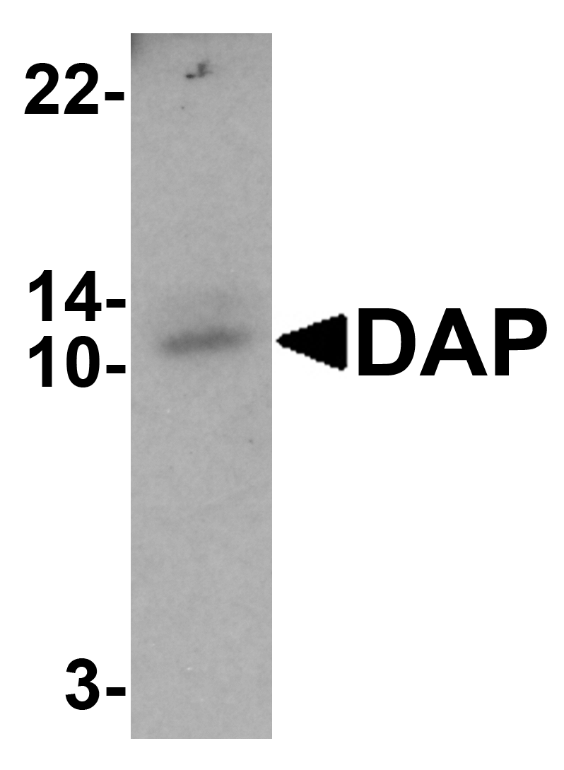 DAP Antibody - C-terminal (OAPB01769) in Small intestine tissue lysate using Western Blot