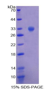ALK Recombinant Protein (OPCD01254) using SDS-PAGE