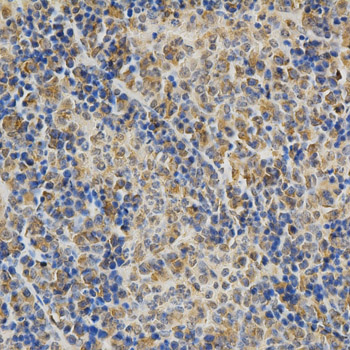 DNMT3A Antibody (OAAN00702) in Mouse Spleen using Immunohistochemistry