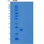 人前梯度蛋白3同源物/AG-3/BCMP11/AGR3重组蛋白C-6His