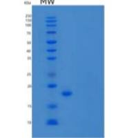 人前梯度蛋白3同源物/AG-3/BCMP11/AGR3重组蛋白C-6His
