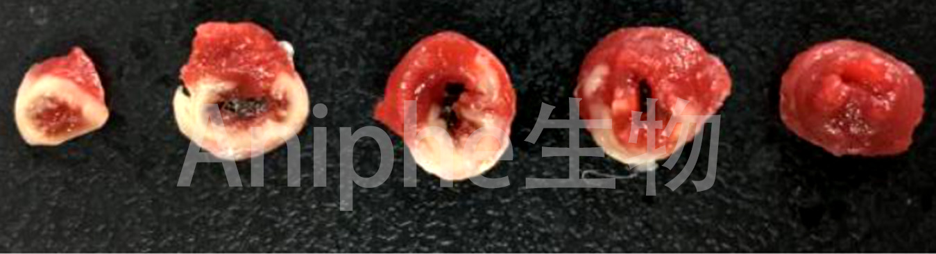 【免费检测超声】心肌梗死(MI)小鼠模型 MI模型 心梗模型