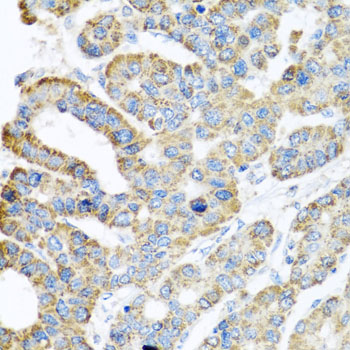 ATPIF1 Antibody (OAAN01164) in Human Liver using Immunohistochemistry