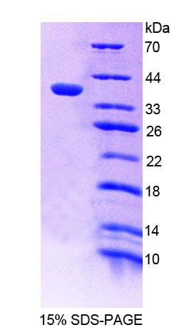 PTPN12 Recombinant Protein (OPCD00395) using SDS-PAGE