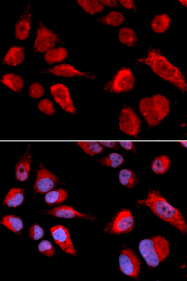 CBS Antibody (OAAN00347) in U20S Cells using Immunofluorescence