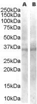 WNT4 Antibody (OASA06495) in Human ovary and human testis using Western Blot