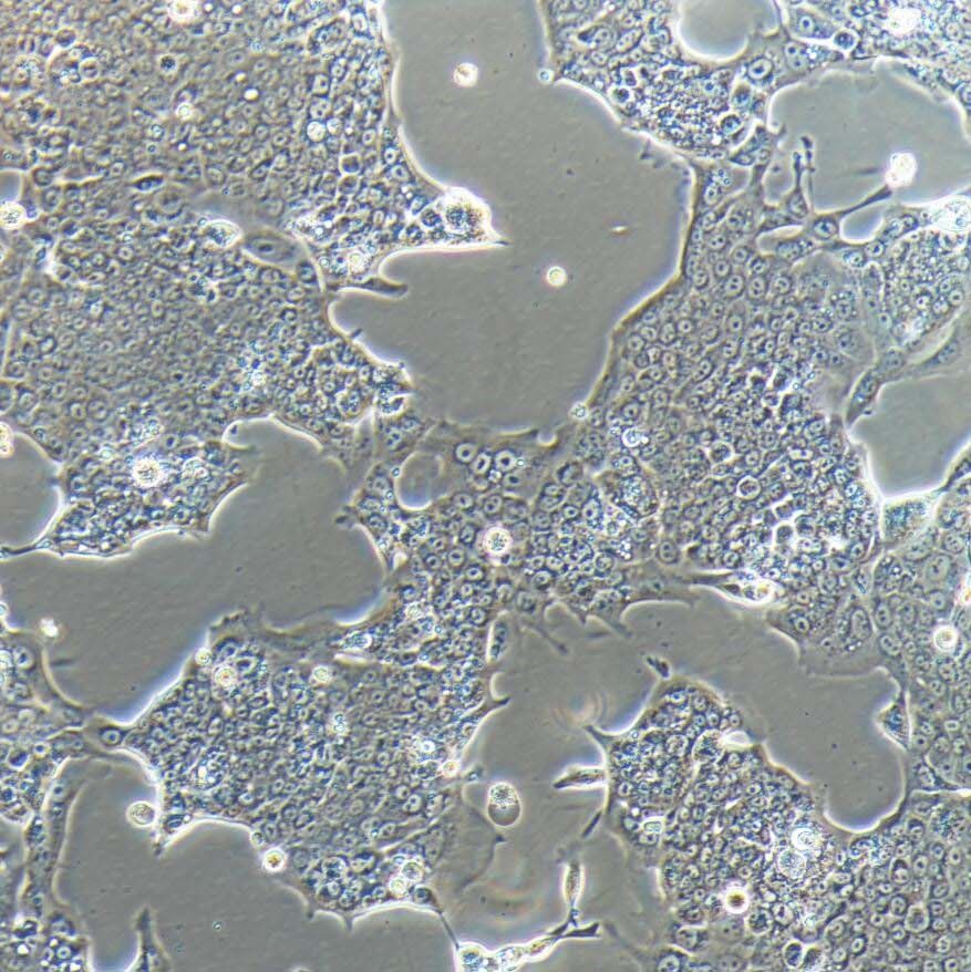 Capan-1人胰腺癌细胞/STR鉴定/镜像绮点（Cellverse）