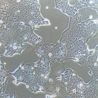 Capan-1人胰腺癌细胞/STR鉴定