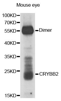 CRYBB2 Antibody (OAAN01374) in Mouse Eye using Western Blot